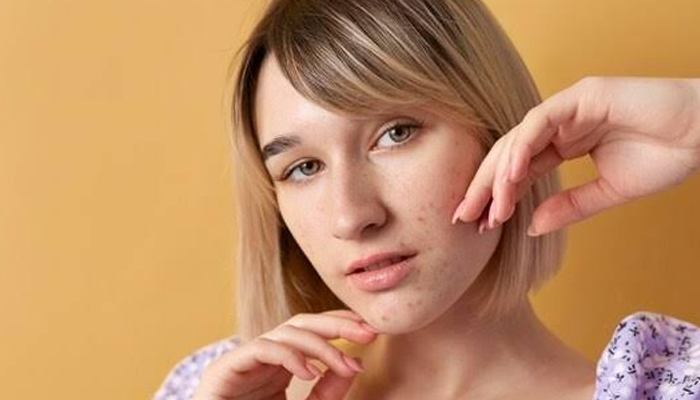 From Dry to Oily Skin: February Skincare Adjustments Explained