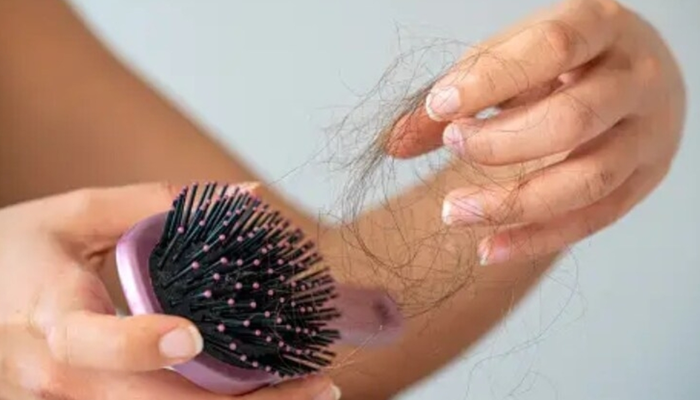 Why Hair Fall Peaks in February (And When to Worry)